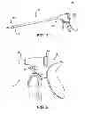 Fig. 02 - Surgical Needle with Steps and Flats