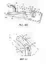 Fig. 08 - Surgical Needle with Steps and Flats