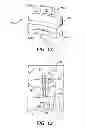 Fig. 09 - Surgical Needle with Steps and Flats