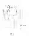 Fig. 09 - Method and apparatus for treating a hip joint, including the provision and use of a novel suture passer
