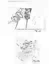 Fig. 20 - TISSUE GRAFT ANCHOR ASSEMBLY AND INSTRUMENTATION FOR USE THEREWITH