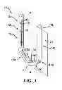 Fig. 02 - Surgical Clip Having Comliant Portion