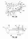 Fig. 03 - Surgical Clip Having Comliant Portion