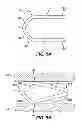 Fig. 07 - Surgical Clip Having Comliant Portion