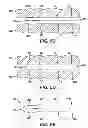 Fig. 08 - Surgical Clip Having Comliant Portion