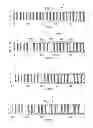 Fig. 06 - Burst mode vitrectomy system