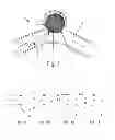 Fig. 02 - Two-stage deployment aneurysm embolization devices
