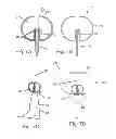 Fig. 06 - Two-stage deployment aneurysm embolization devices