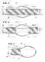 Fig. 04 - THREADED BALLOON CATHETER SEAL FIELD OF DISCLOSURE