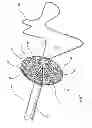 Fig. 02 - Assembly and method for left atrial appendage occlusion