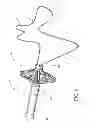 Fig. 03 - Assembly and method for left atrial appendage occlusion