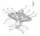 Fig. 07 - Assembly and method for left atrial appendage occlusion