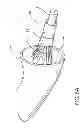 Fig. 09 - Assembly and method for left atrial appendage occlusion