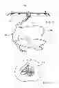 Fig. 15 - Assembly and method for left atrial appendage occlusion