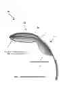 Fig. 01 - SYSTEM FOR FACILITATING TRANSCATHETER AORTIC VALVE PROCEDURES USING FEMORAL ACCESS