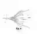 Fig. 04 - Apparatus and method for the delivery of an intravascular filter