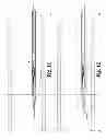 Fig. 07 - Apparatus and method for the delivery of an intravascular filter