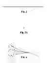 Fig. 03 - Apparatus and method for the retrieval of an intravascular filter