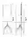 Fig. 05 - Apparatus and method for the retrieval of an intravascular filter
