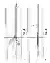 Fig. 07 - Apparatus and method for the retrieval of an intravascular filter