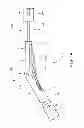 Fig. 02 - Device with Deflectable Distal End and Related Methods of Use