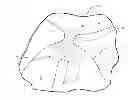 Fig. 01 - Devices for reducing the size of an internal tissue opening