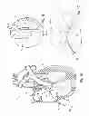 Fig. 02 - Devices for reducing the size of an internal tissue opening
