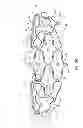 Fig. 04 - Devices for reducing the size of an internal tissue opening