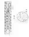 Fig. 05 - Devices for reducing the size of an internal tissue opening