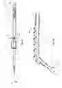 Fig. 06 - Devices for reducing the size of an internal tissue opening