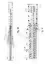 Fig. 07 - Devices for reducing the size of an internal tissue opening