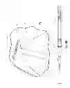 Fig. 10 - Devices for reducing the size of an internal tissue opening