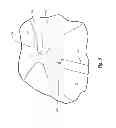 Fig. 11 - Devices for reducing the size of an internal tissue opening