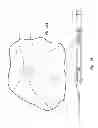 Fig. 12 - Devices for reducing the size of an internal tissue opening
