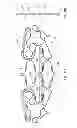 Fig. 13 - Devices for reducing the size of an internal tissue opening