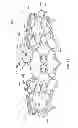 Fig. 17 - Devices for reducing the size of an internal tissue opening