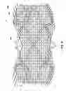 Fig. 20 - Devices for reducing the size of an internal tissue opening