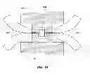 Fig. 21 - Devices for reducing the size of an internal tissue opening