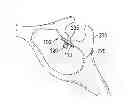 Fig. 01 - Cranial base implant device