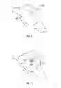 Fig. 05 - Cranial base implant device