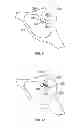 Fig. 06 - Cranial base implant device