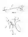 Fig. 02 - Surgical Needle with Formed Steps