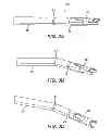 Fig. 03 - Surgical Needle with Formed Steps