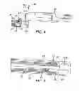 Fig. 04 - Surgical Needle with Formed Steps