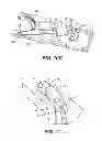Fig. 08 - Surgical Needle with Formed Steps
