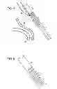 Fig. 04 - Surgical anchor delivery system