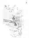 Fig. 11 - Apparatus and devices for percutaneously extending an existing spinal construct