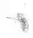 Fig. 12 - Apparatus and devices for percutaneously extending an existing spinal construct