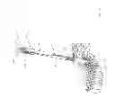 Fig. 16 - Apparatus and devices for percutaneously extending an existing spinal construct