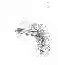 Fig. 19 - Apparatus and devices for percutaneously extending an existing spinal construct